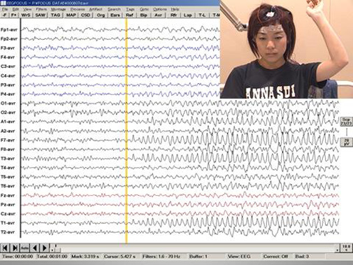ビデオ-脳波の画面