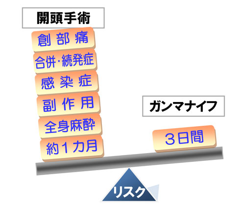 開頭手術とガンマナイフ手術のリスク比較